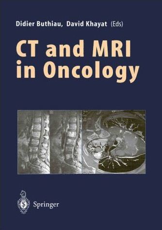 Primary Malignant tumors of bone and soft tissues