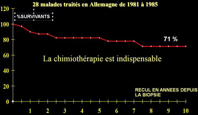 sarcome tenosynovial