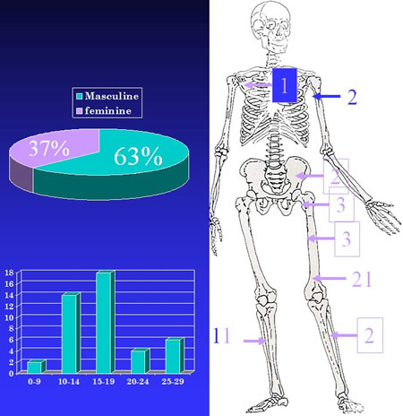 osteosarcoma