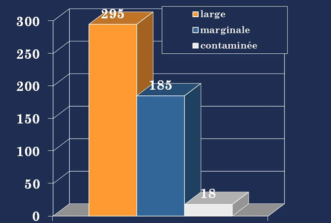 biopsie sarcomes osseux