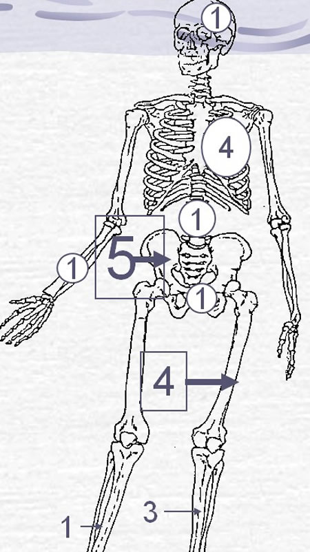 Ewing's sarcoma