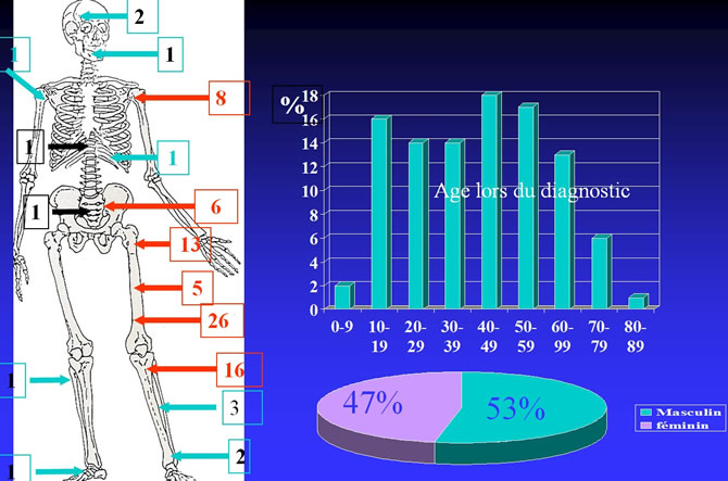 IRM diagnostic précoce