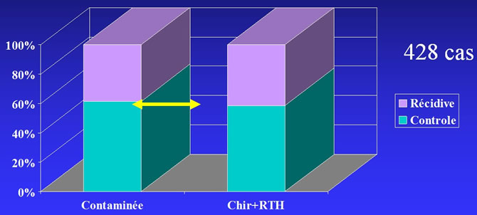 Fibromatose radiothérapie