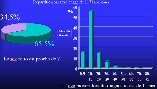 Exostoses Ostéogéniques enfant