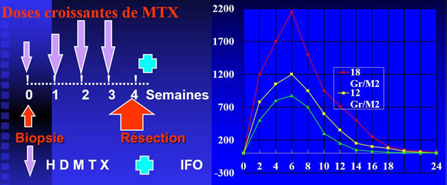 méthotrexate