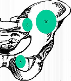 location of tumors