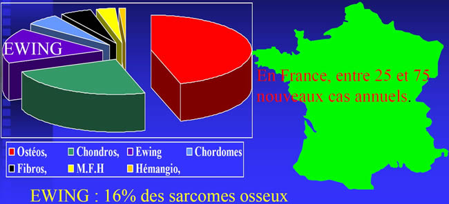 statistiques sarcomes osseux ewing