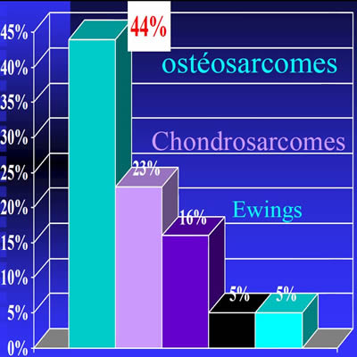fréquence ostéosarcome