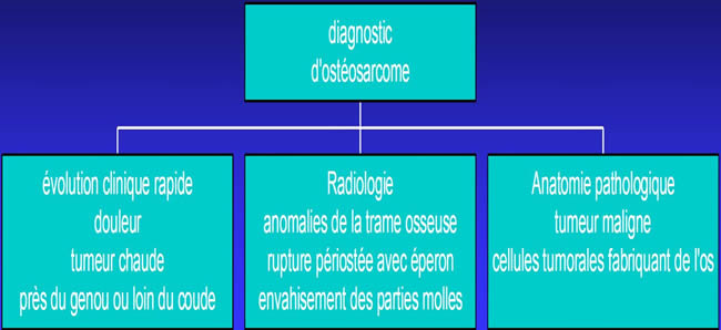 diagnostic ostéosarcomes