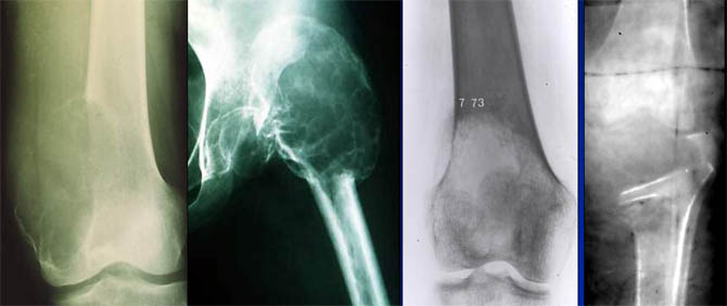 Radiographie