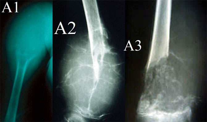 Diagnostique