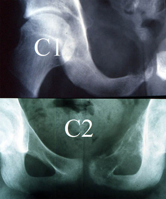 Diagnostique 4