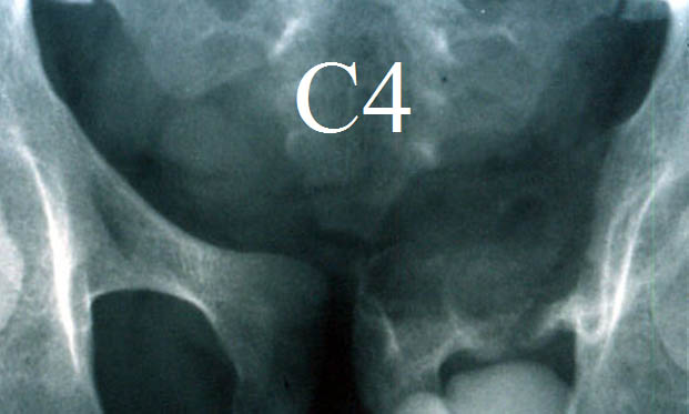 Diagnostique 6