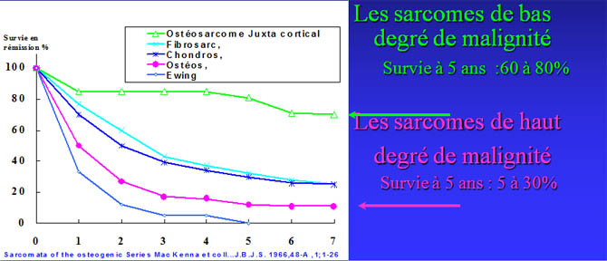 Sarcomes