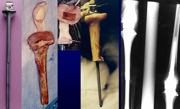 Skeletal Reconstructions