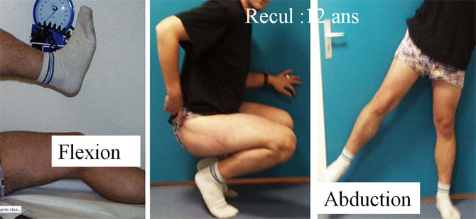 Resultat fonctionnel apres resection