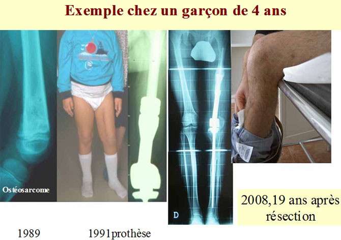 Exemple garcon de 4 ans