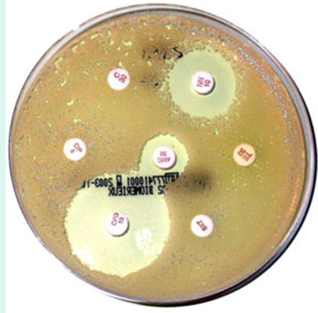 Staphylococcus aureus