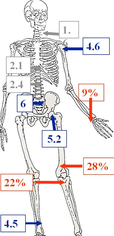 Tumeurs à cellules géantes