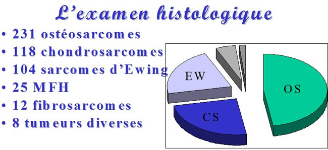 traitement chirurgical des sarcomes osseux