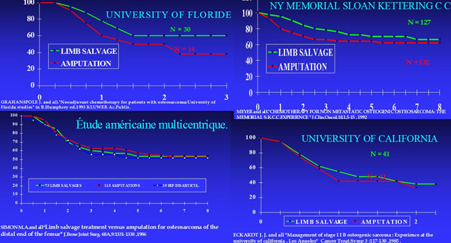 traitement chirurgical des sarcomes osseux