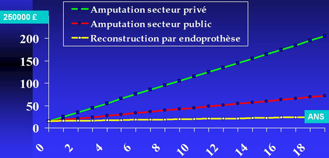 traitement chirurgical des sarcomes osseux