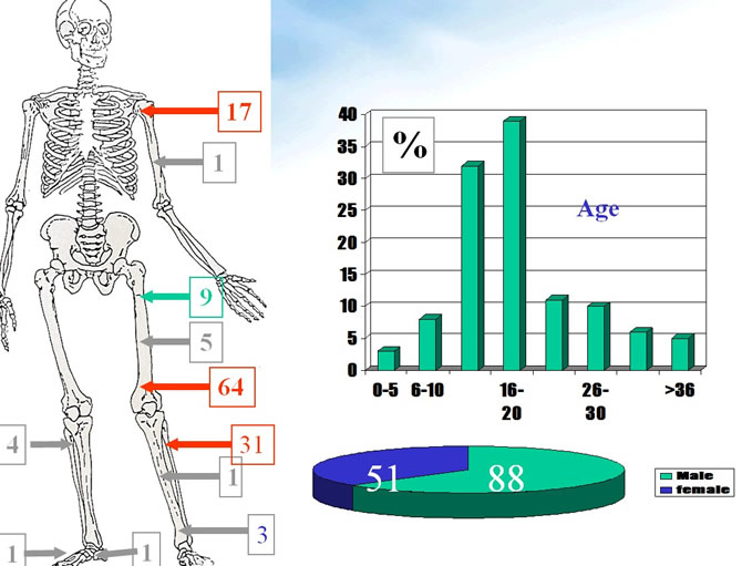 osteosarcoma