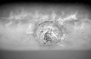Infection prothèse massive du tibia