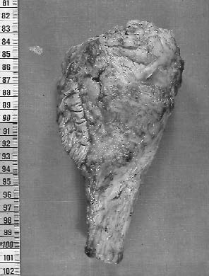 Piède de disection monobloc