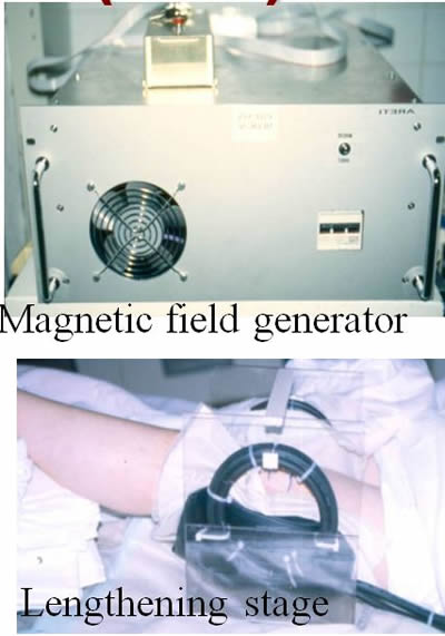 Magnetic prosthesis